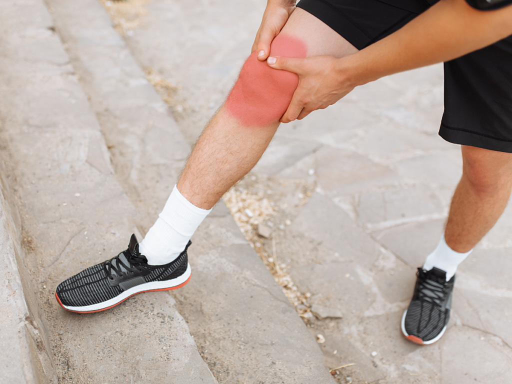 Knee Bursitis Symptoms